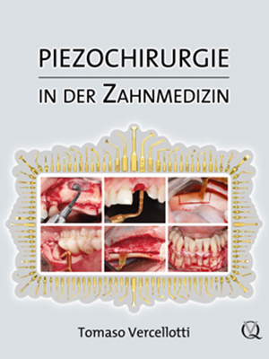 Piezochirurgie Piezochirurgie