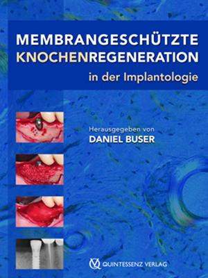Membrangeschuetzte Knochenregeneration Membrangeschuetzte Knochenregeneration