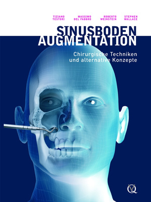 Sinusboden Augmentation Sinusboden Augmentation